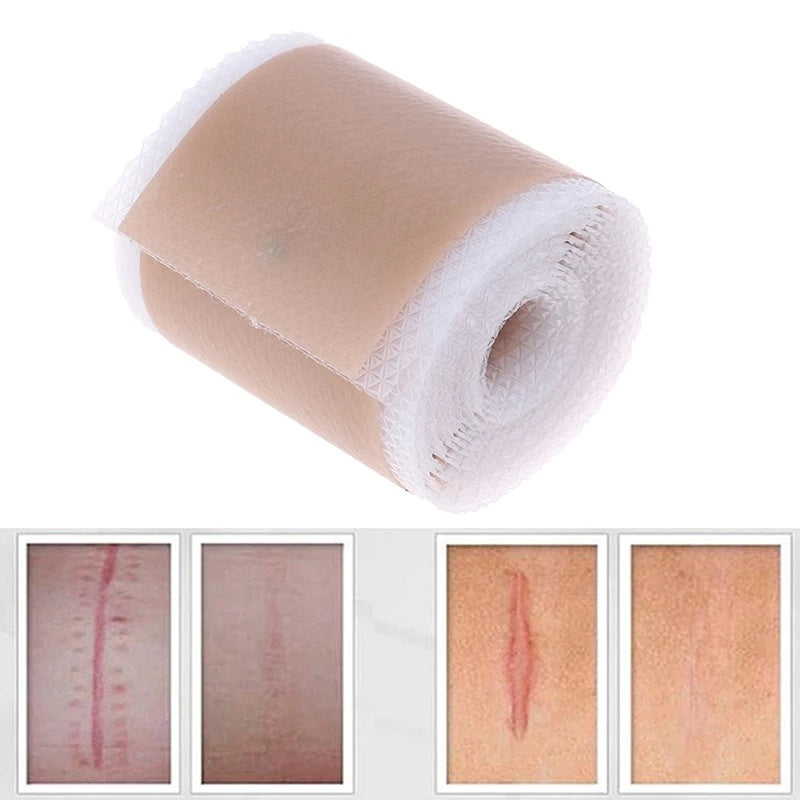 Skin Color Silicone Gel Tape Ear Tape