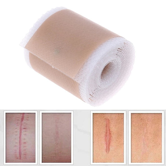 Skin Color Silicone Gel Tape Ear Tape